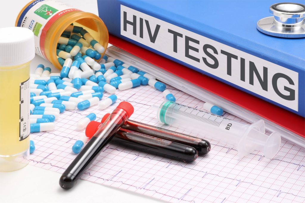 HIV - https://www.thebluediamondgallery.com/medical/h/hiv-testing.html